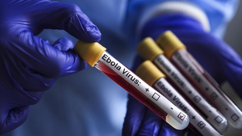 Ebola Bundibugyo Virüsü Salgınında Son Durum Açıklandı