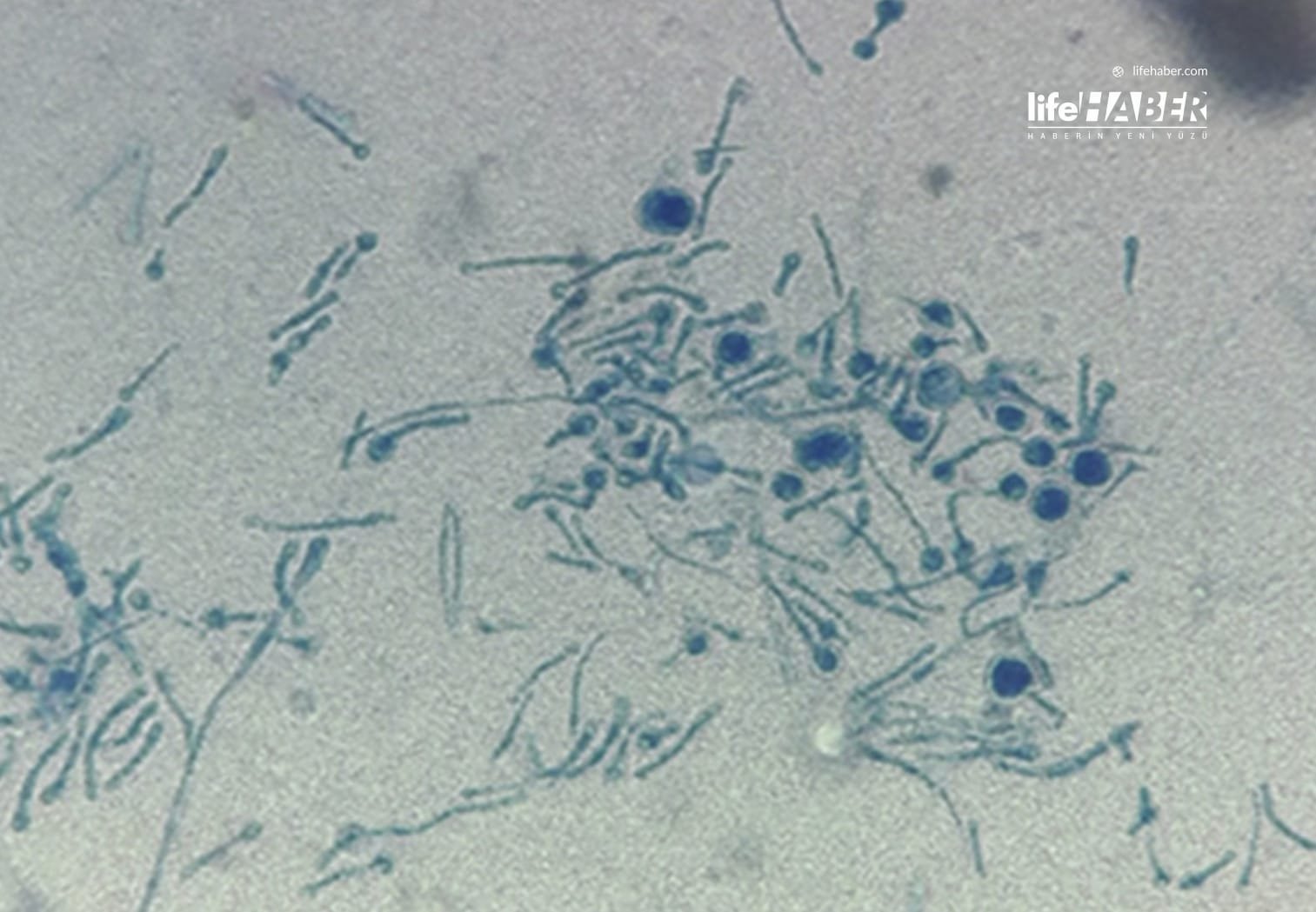 İnsana Bulaştığı Bilinen İlk Vaka