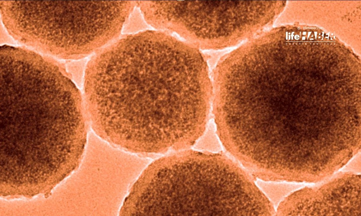 Nanobotlar Beyin Kanamalarını Durdurabilecek