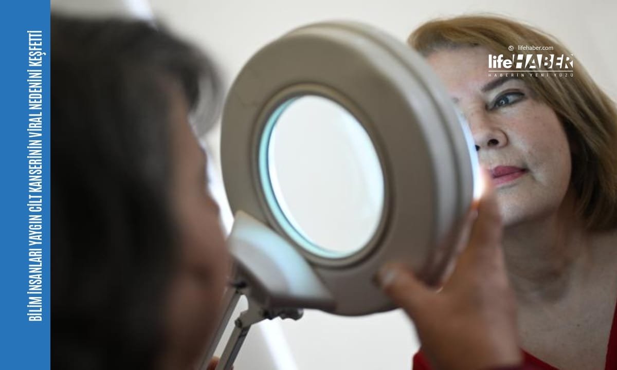 Bağışıklığı Zayıf Bireylerde Cilt Kanseri Tetikleyicisi: Zararsız HPV Türü