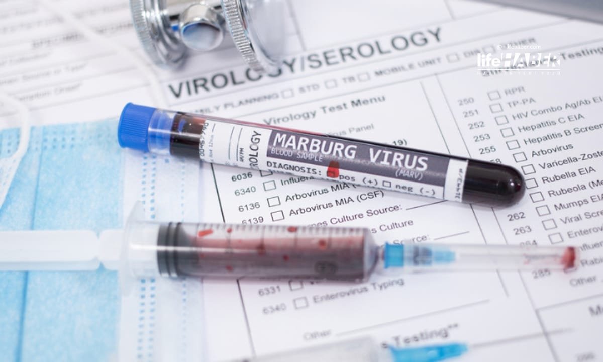 Etiyopya’da İlk Ölümcül Marburg Virüsü Salgını Doğrulandı: Bölgede Alarm Verildi