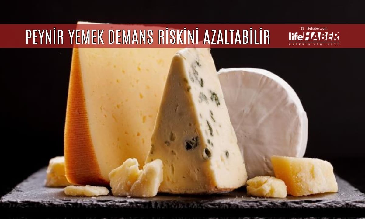 🧀 Peynirin Zihin Sağlığı Üzerindeki Mucizevi Etkisi